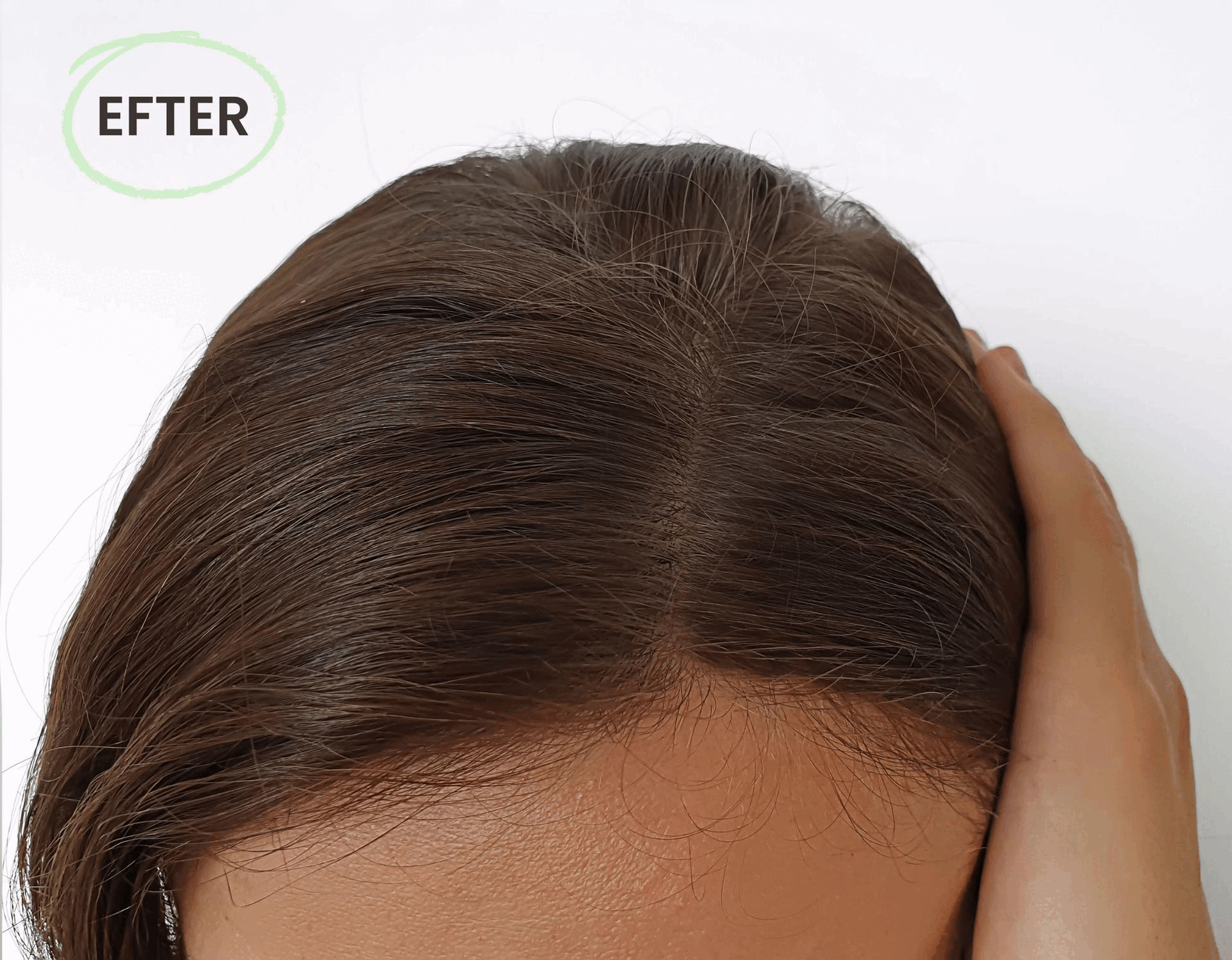 Resultat i hårbotten efter användning av Rosmarin & Koffein schampo